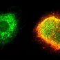 Macrophage humain infecté par le virus Lassa (Arénavirus) 