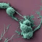 Deux cellules neuronales (CAD) en connexion par un nanotube TNT © Institut Pasteur/Karine Gousset et Chiara Zurzolo,
