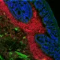 	Colon murin dont le noyau des cellules est marqué en bleu, les cellules elles-mêmes en vert, et les bactéries en rouge (par coloration de leur ARN ribosomique). Des débris d'aliments sont également visibles en vert dans la lumière intestinale