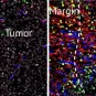 Les cellules stromales en marge de la tumeur © Institut Pasteur