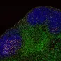 Anticorps anti-PD-1 - cellules T - ganglions lymphatiques - Institut Pasteur
