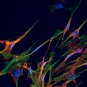 Détection du virus Chikungunya © Institut Pasteur/Thérèse Couderc et Marc Lecuit 