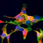 Détection du virus Chikungunya dans des cellules Véro en culture en microscopie à fluorescence - Institut Pasteur