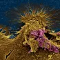Bactéries Escherichia coli ©  Institut Pasteur/Chantal Le Bouguénec