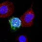 VIH lymphocytes copyright Institut Pasteur