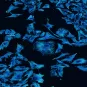 Cellules de glioblastome humain © Institut Pasteur