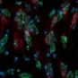 Cellules humaines infectées par Chlamydia trachomatis © Institut Pasteur/Sébastien Triboulet et Agathe Subtil