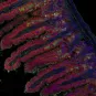  Imagerie en fluorescence de villosités intestinales après infection par Listeria monocytogenes ©  Institut Pasteur