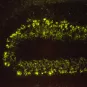 Cervelet de rat infecté par le virus de la rage - Institut Pasteur