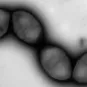 Chainette de Streptococcus pneumoniae en microscopie électronique à transmission.