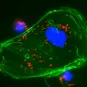 Observation en microscopie à fluorescence d'une cellules infectée par Listeria ©  Institut Pasteur/Edith Gouin et Pascale Cossart