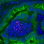 Tissu intestinal de gerbille infecté par Listeria monocytogenes. Listeria monocytogenes est marquée en rouge, la E-cadhérine des cellules épithéliales en vert, et les noyaux cellulaires en bleu. Institut Pasteur/Biologie des Infections - Marc Lecuit