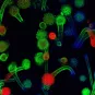 Photo de microscopie - Têtes aspergillaires d'Aspergillus fumigatus en milieu aérien.
