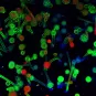 Têtes aspergillaires d'Aspergillus fumigatus en milieu aérien