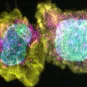 Virus de la rougeole perturbant le réseau mitochondrial et le métabolisme cellulaire