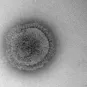 Photomicrographie du virus de la grippe A. 