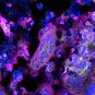 Microscopie à fluorescence de cellules infectées par le virus SARS-CoV-2 