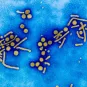 Virus de l'hépatite B (VHB) en microscopie électronique. L'hépatite B chronique peut être à l'origine de cancer du foie et de cirrhose. Virus enveloppé à ADN. Particules de Dane complètes, sphérules de 20 nanomètres de diamètre, et tubules ou filaments de