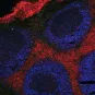 Plaques de Peyer vues du dessus. Il s'agit d'une population de lymphocytes qui "veillent "sur l'intestin