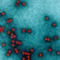 Photographie de microscopie colorisée d'un poliovirus