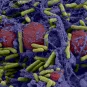 Biofilm de bactéries Pseudomonas aeruginosa formé dans un catheter central.