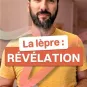 La lèpre : révélation