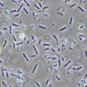observation au microscope d’une culture de Clostridium botulinum à l’état frais (grossissement x1000).