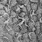 Cellules ciliées dans le noeud d'une souris mutante, vues par microscopie électronique à balayage. Ce modèle avec des cils paralysés permet de mieux comprendre comment le cœur se forme et reconnaît la droite et la gauche.