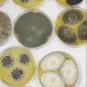 medical mycology
