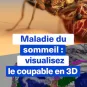 Maladie du sommeil