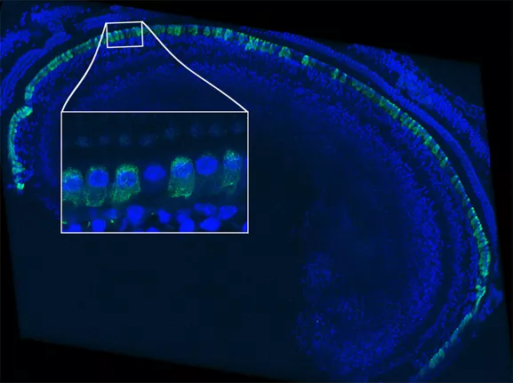 Image par immunofluorescence de l’épithélium sensoriel d’une cochlée de souris traitée par thérapie génique. Les cellules ciliées internes ont été marquées en vert pour révéler l’otoferline. L’otoferline est détectée dans la quasi-totalité de ces cellules. La zone à fort grossissement dans l’encadré montre une cellule ciliée interne qui n’a pas été transduite.