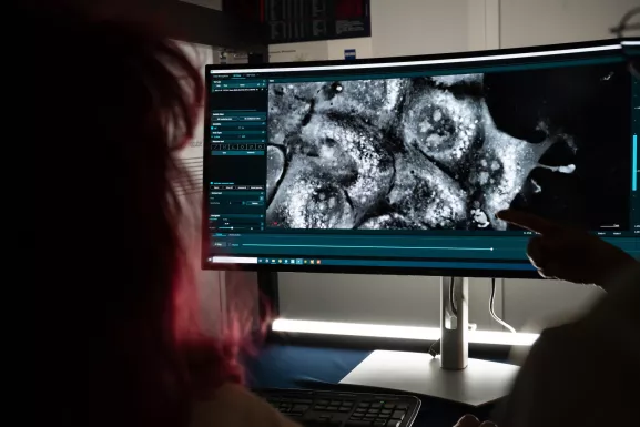 Reportage dans la Plate-forme technologique BioImagerie Photonique à l'Institut Pasteur. Observation de cellules progénitrices de foie en cours de division cellulaire.