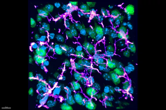 Macrophages dans le cerveau