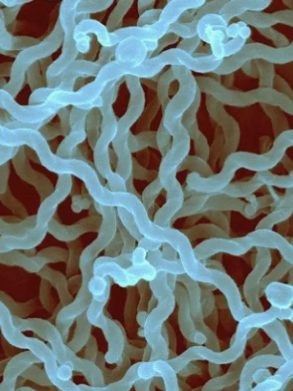 Leptospirose - Institut Pasteur