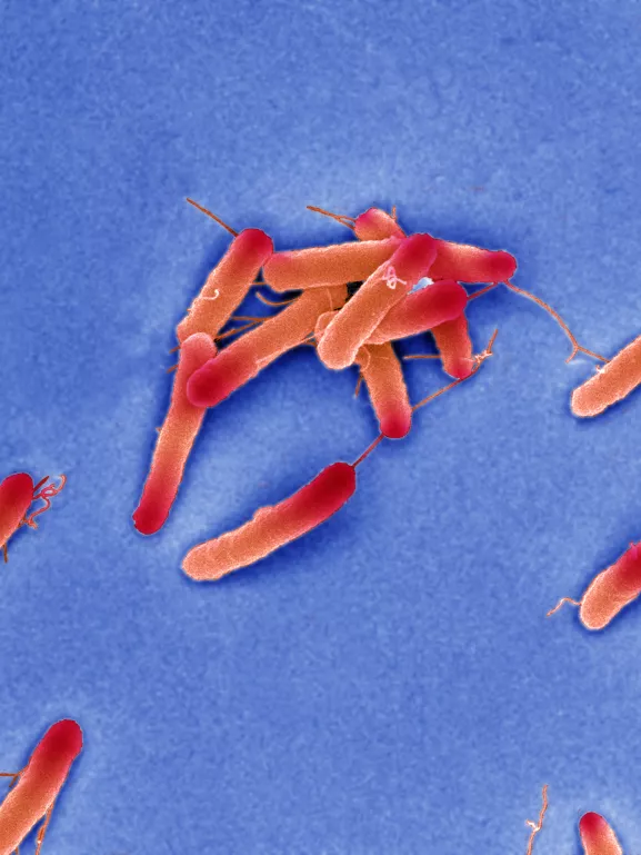 Bactéries Escherichia coli en microscopie électronique à balayage