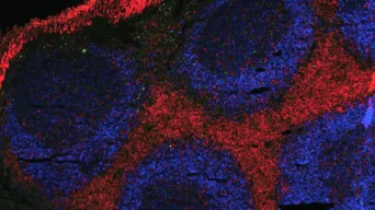 Plaques de Peyer vues du dessus. Il s'agit d'une population de lymphocytes qui "veillent "sur l'intestin