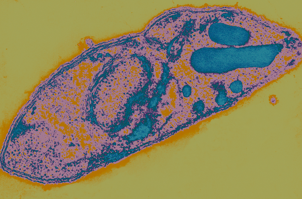 Santé Publique - CCOMS - Surveillance des résistances aux molécules antipaludiques - Institut Pasteur