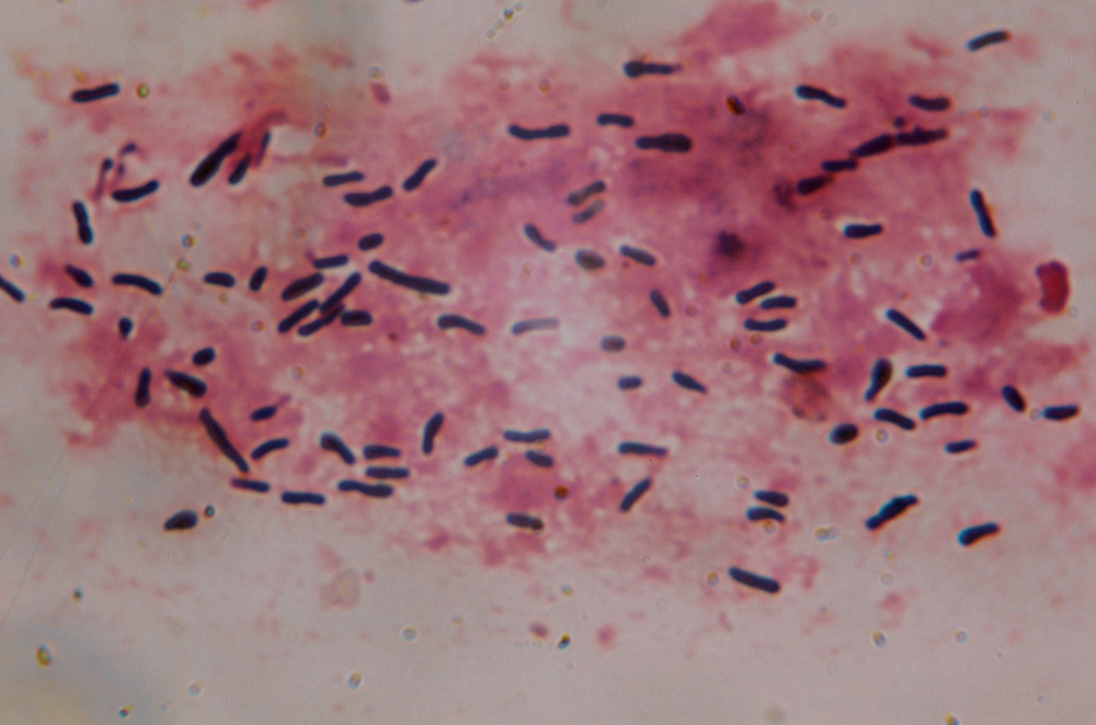 Santé Publique - CNR - Corynebactéries du complexe diphtheriae - Institut Pasteur