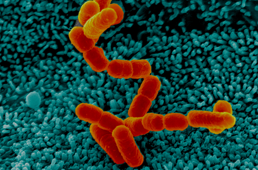Santé Publique - CNR - Escherichia coli, Shigella, Salmonella - Institut Pasteur