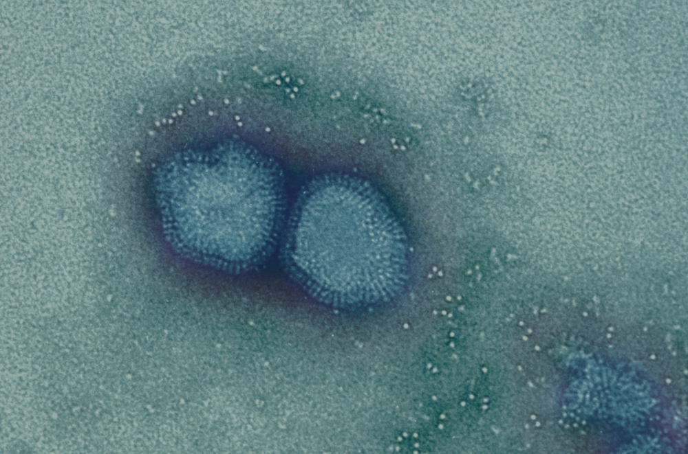 Santé Publique - CNR - Virus influenzae (Grippe) - Institut Pasteur