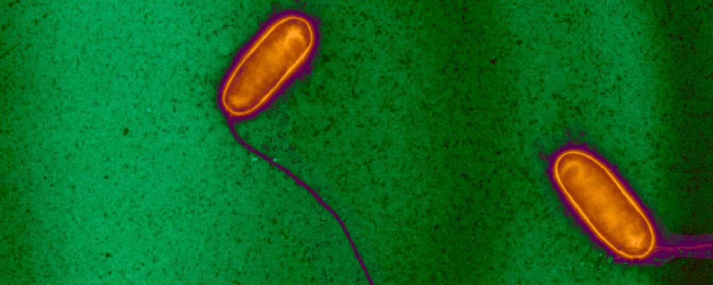 Légionellose : informations et traitements - Institut Pasteur
