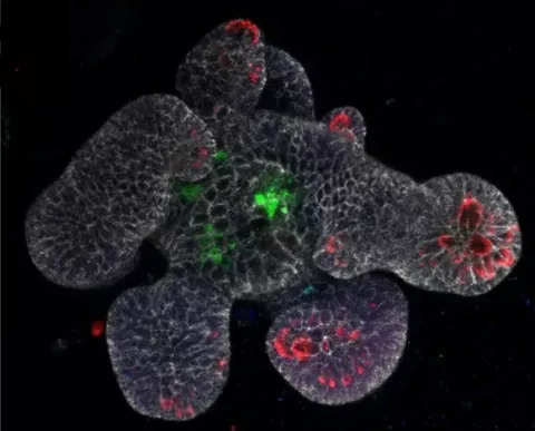 Goblet cell Listeria - Institut Pasteur