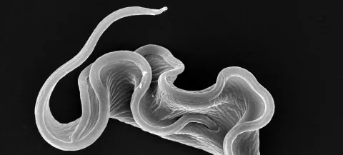Forme sanguine de Trypanosoma brucei