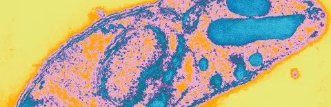 Santé Publique - CCOMS - Surveillance des résistances aux molécules antipaludiques - Institut Pasteur