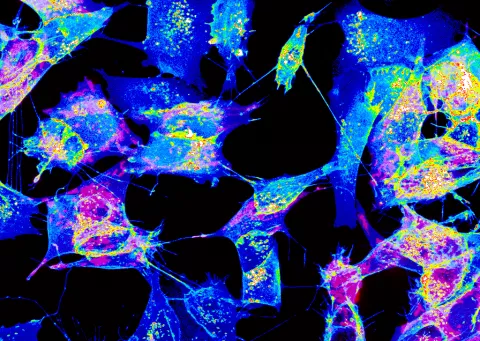 Plusieurs cellules connectées par des nanotubes