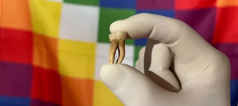 Dent archéologique provenant de restes humains d'Amérique du Sud. 