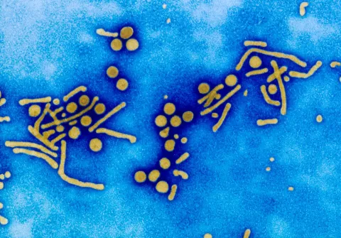 Virus de l'hépatite B (VHB) en microscopie électronique. L'hépatite B chronique peut être à l'origine de cancer du foie et de cirrhose. Virus enveloppé à ADN. Particules de Dane complètes, sphérules de 20 nanomètres de diamètre, et tubules ou filaments de