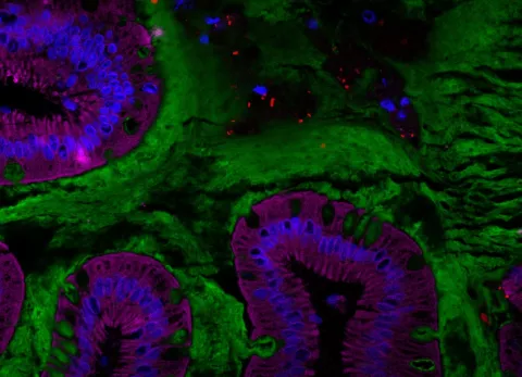 Coupe d’intestin humain représentant le microbiote intestinal