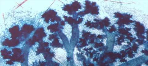 Morphologie d’une glande mammaire de souris