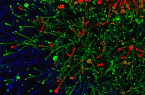 Têtes aspergillaires d'Aspergillus fumigatus en milieu aérien